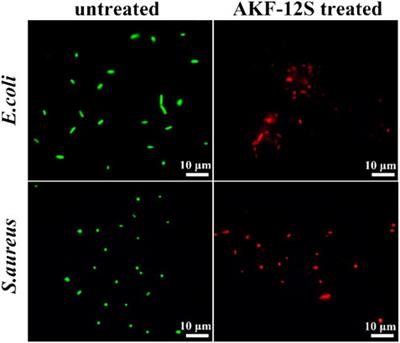 Peptide hydrogel based sponge patch for wound infection treatment